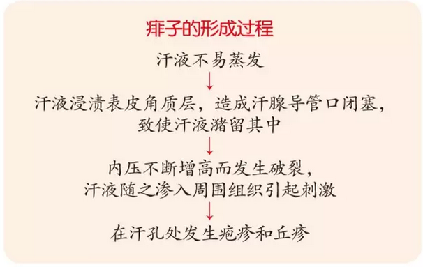 夏日“祛痱大战” | 痒在孩子身，疼在妈妈心，来看祛痱妙招！-幼师课件网第5张图片